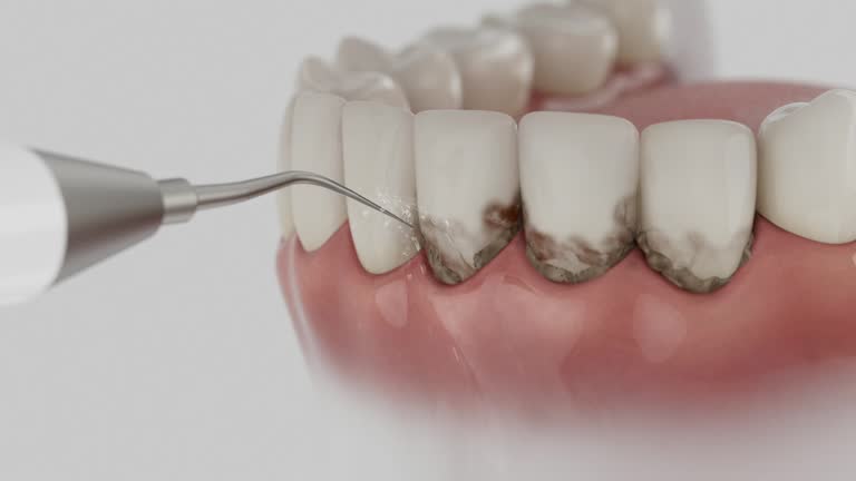 Trusted Dental Crowns And Bridges service in Spring Green, WI - Dentist Open Now